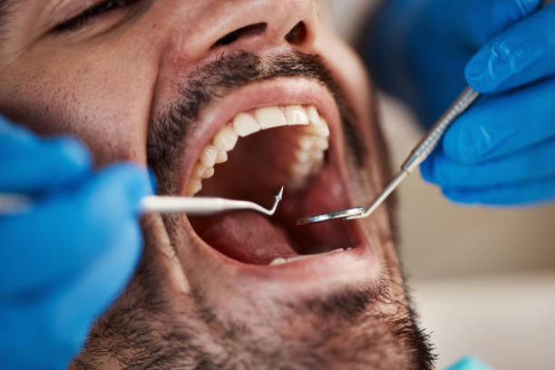Best Broken or Cracked Tooth Emergency Dentist in Canal Winchester, OH